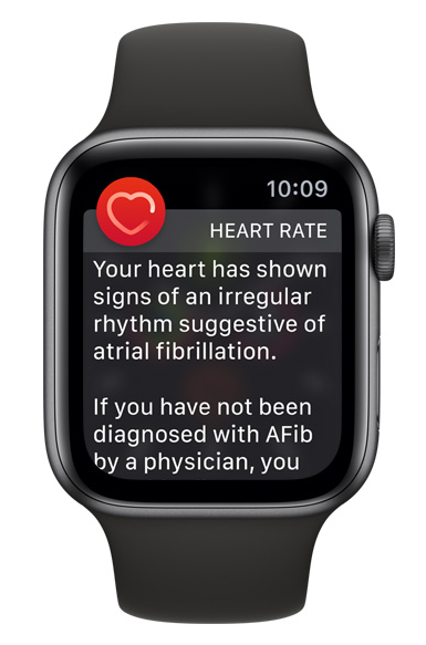 Apple Watch: EKG Warning