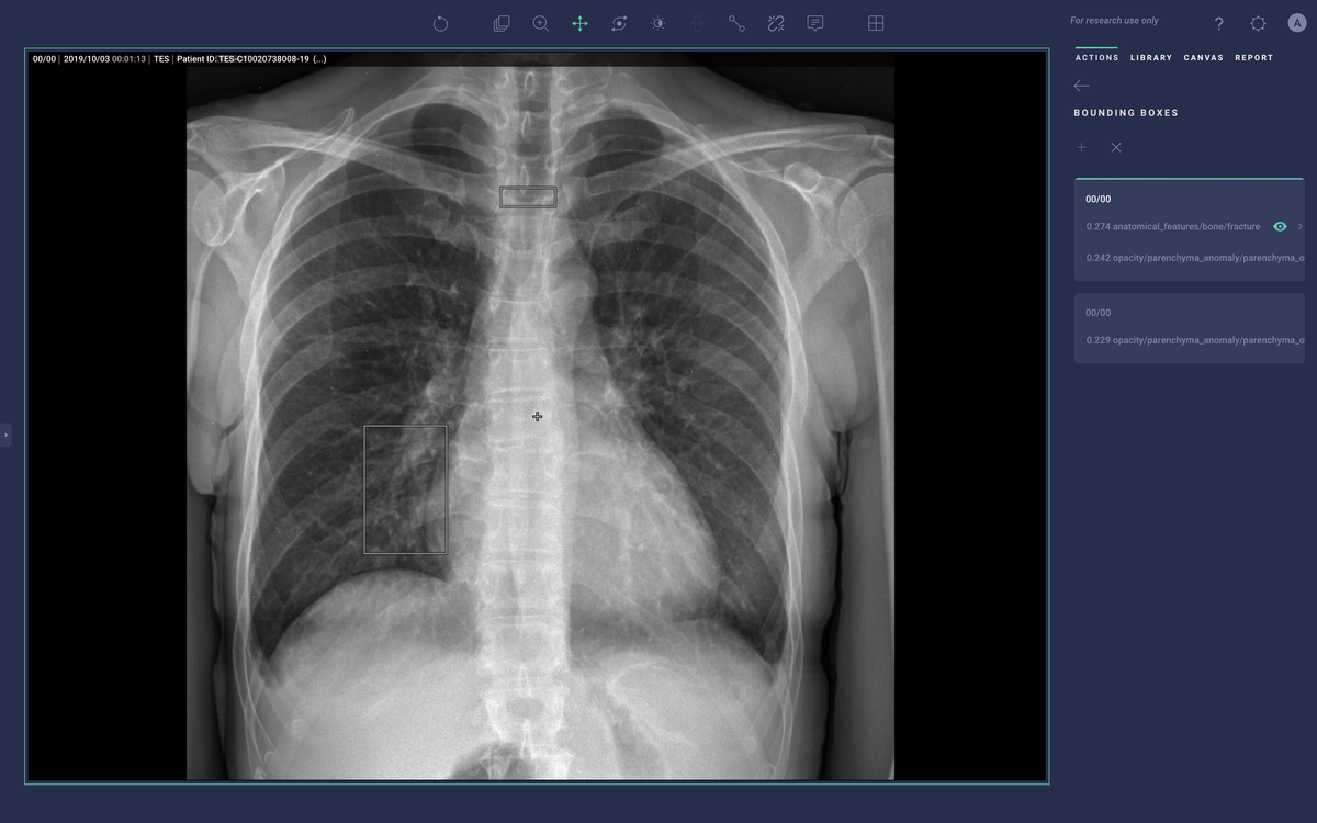 Arterys Chest/MSK Pathology Detection: Lung