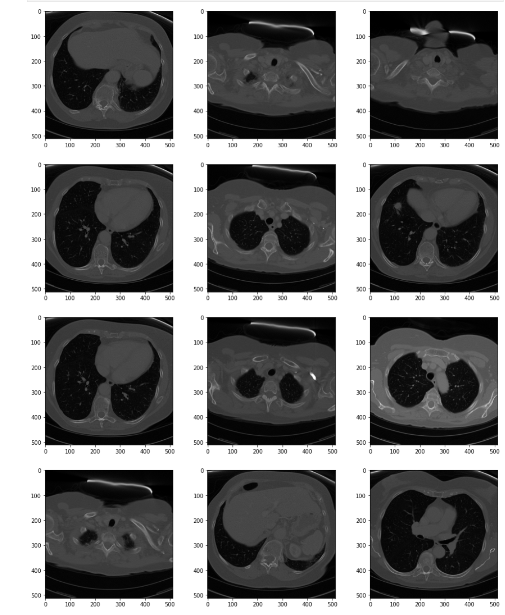 Figure: Series of Images from a Raw Chest CT Scan