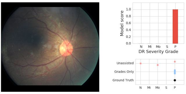 Google Diabetic Retinopathy Study: Patient 1