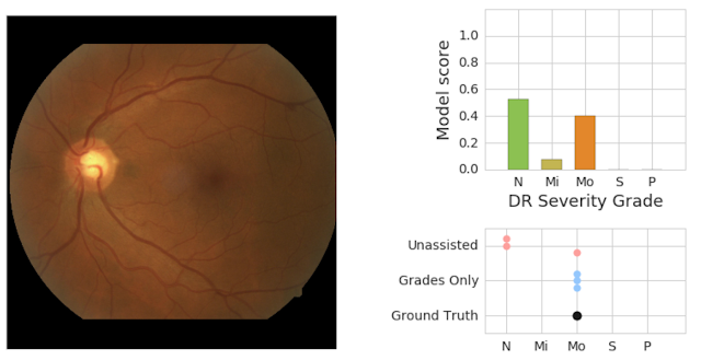 Google Diabetic Retinopathy Study: Patient 2