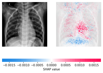 Figure: SHAP Scores for Chest X-Ray