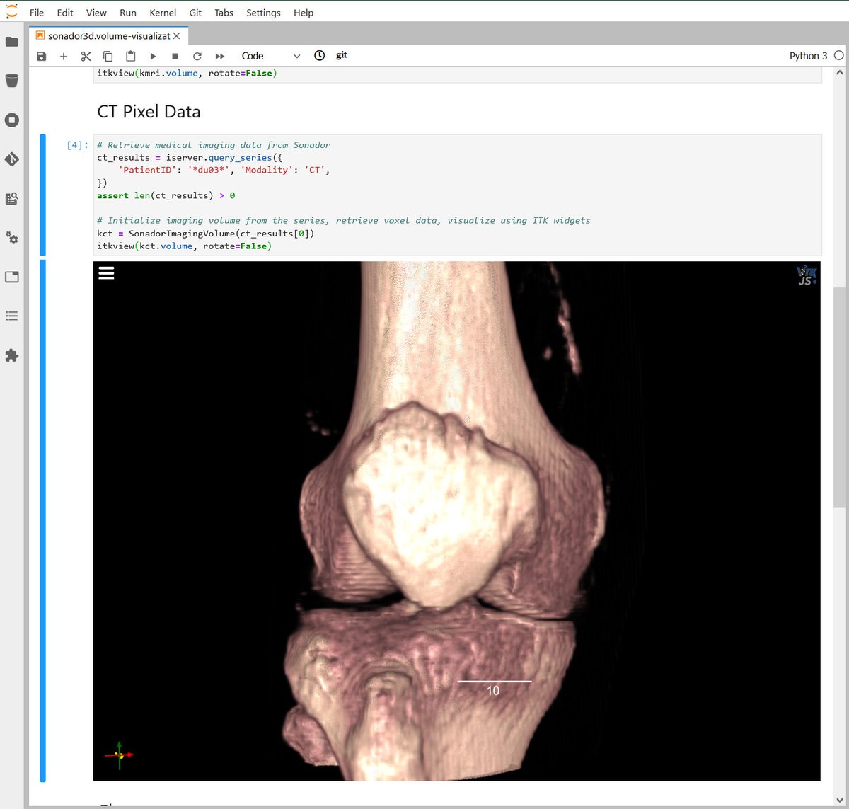 Sonador 3D: CT Volume of Knee in JupyterLab