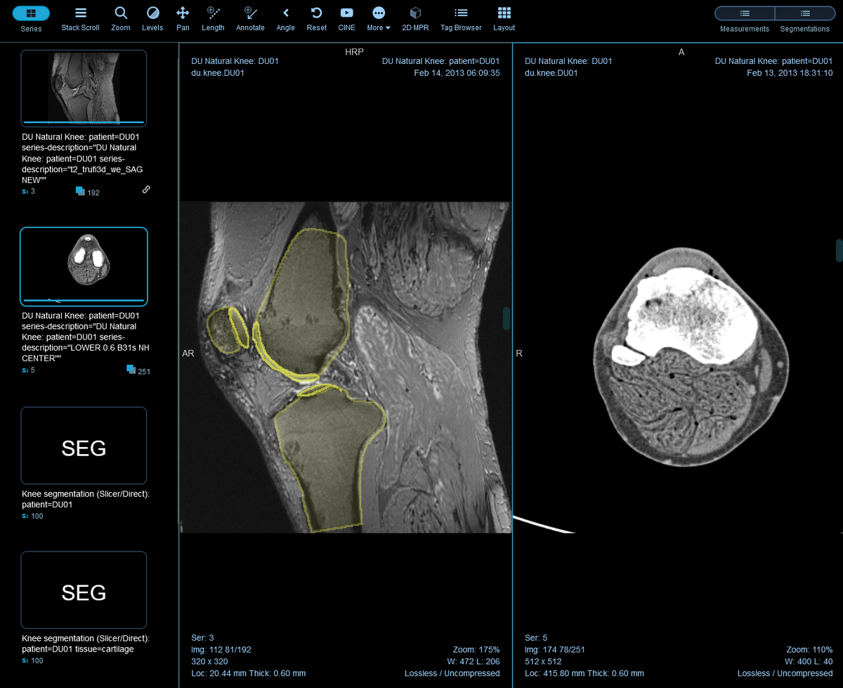 Sonador Viewer: Multi-modality MRI/CT/SEG