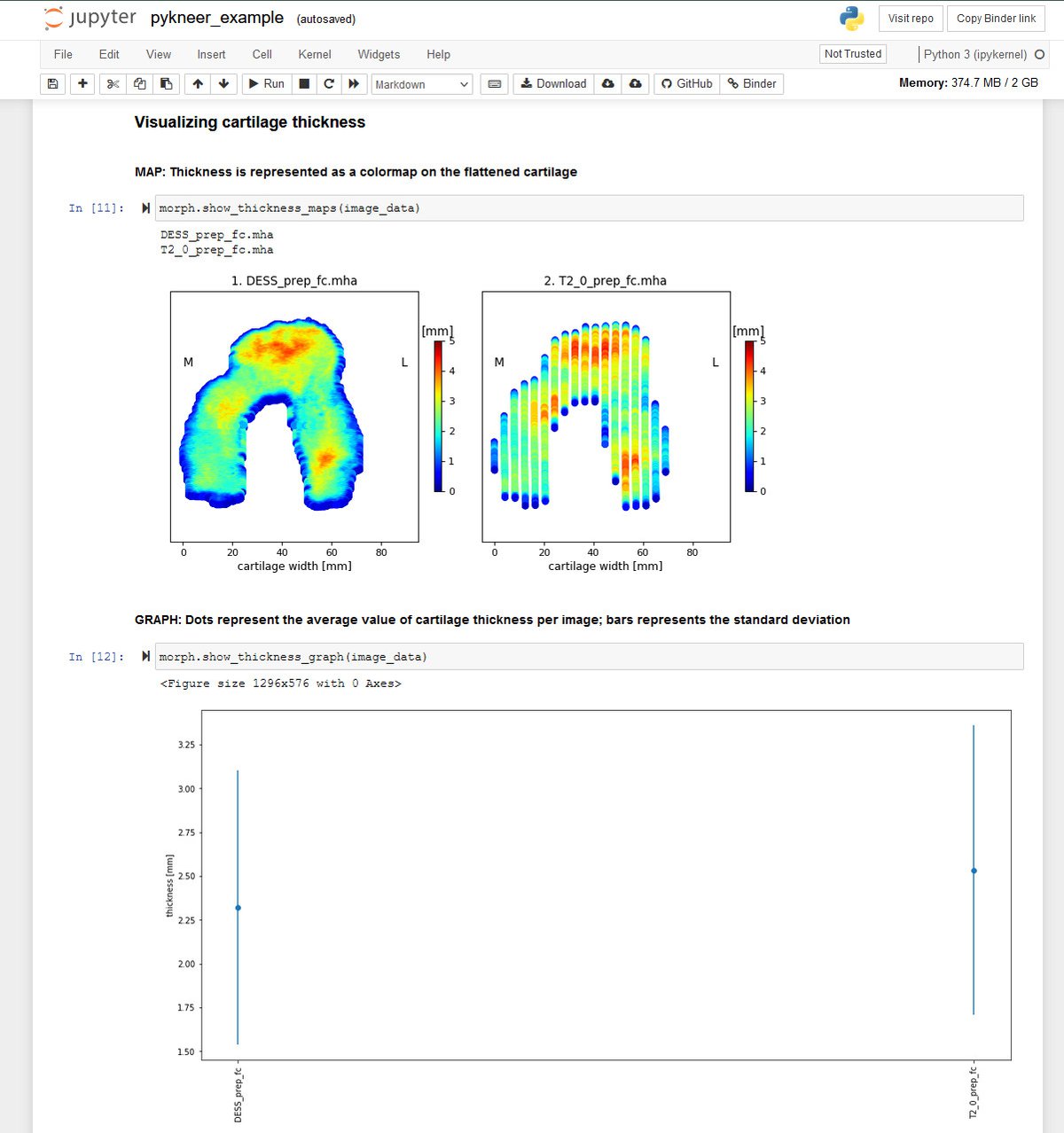 PyKNEEr: Assessing Cartilage Thickness