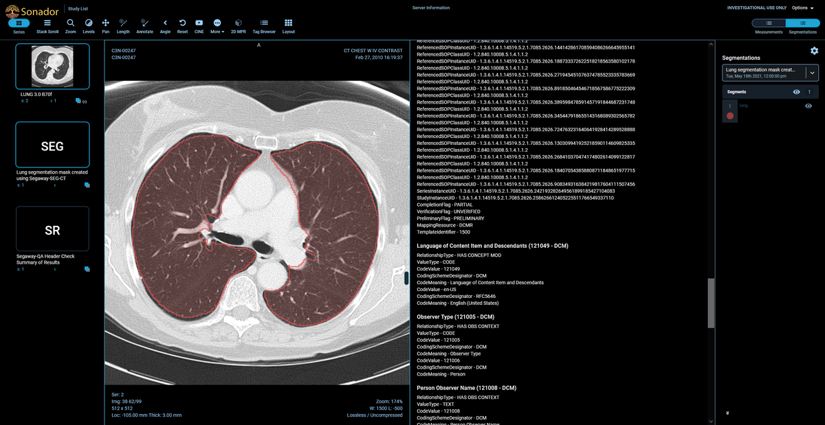 Sonador UI: CT Scan and DICOM-SR document