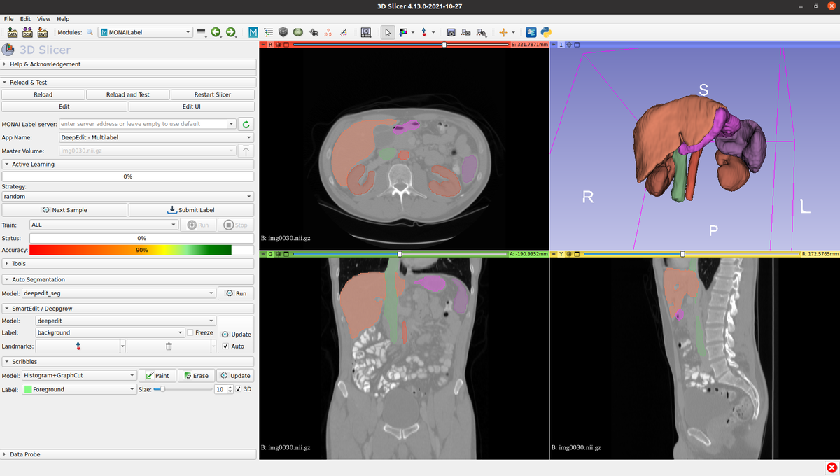 Sonador/MONAI Label: MONAI Label is a framework which facilitates interactive medical image annotation