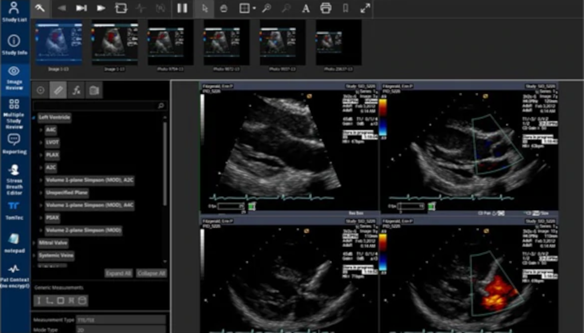 IBM Health: Merge Cardio